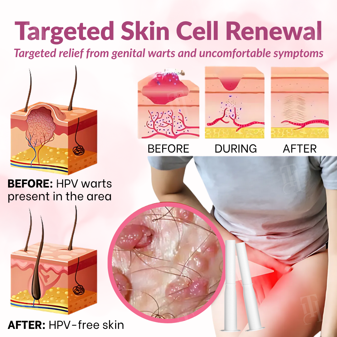 Piguiay® Femina HPV Relief Gel