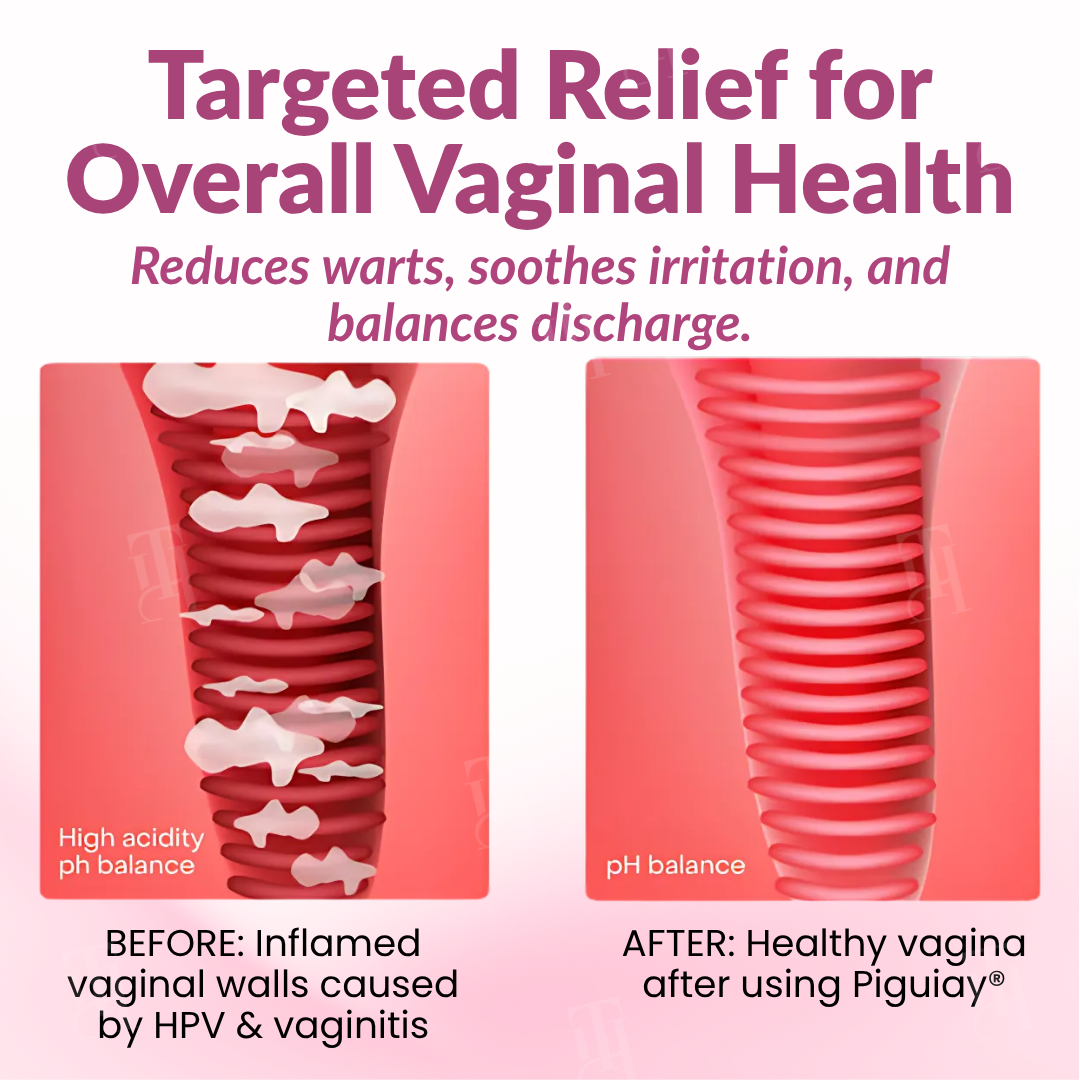 Piguiay® Femina HPV Relief Gel